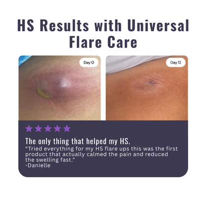Hidradenitis Suppurativa (HS) Flare Care