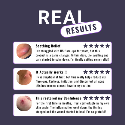 Hidradenitis Suppurativa (HS) Flare Care